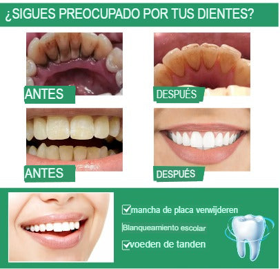 BLANQUEADOR DE DIENTES 7DAYS